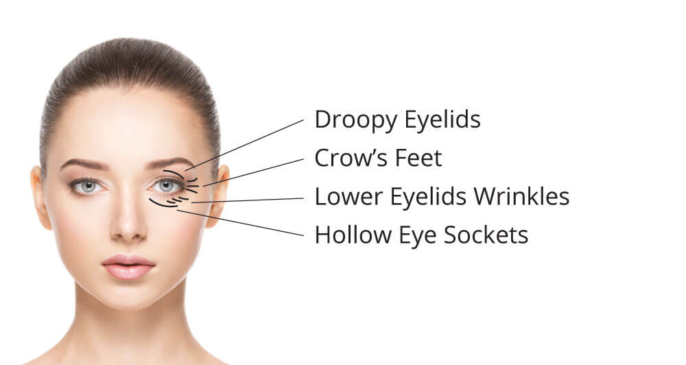 Anti-Ageing Eye Contouring Needling
