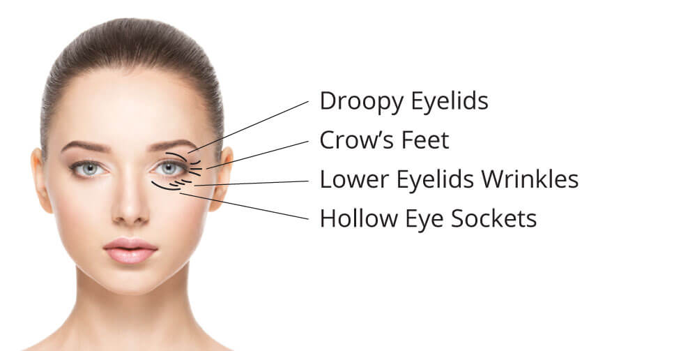 Anti-Ageing Eye Contouring Needling