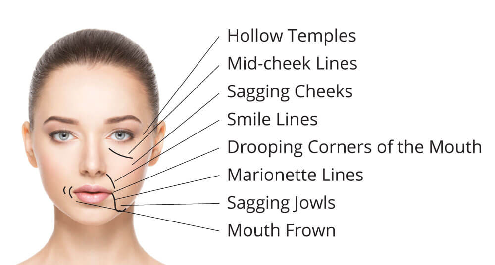 Anti-Ageing Facial Contouring Needling