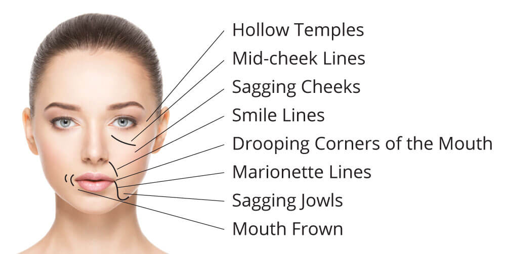 Anti-Ageing Facial Contouring Needling